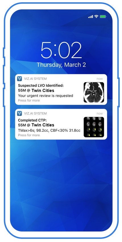 Stroke AI Idenfitier images for mobile 2