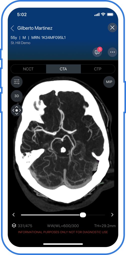 Stroke AI Idenfitier images for mobile 4