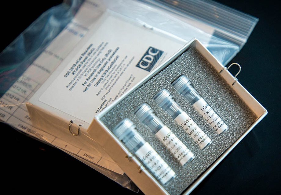 Test for Immunity Could Arrive in U.S.